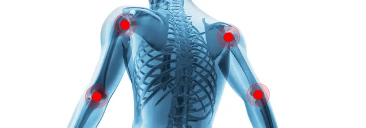 Bursitis Chiropactic Care